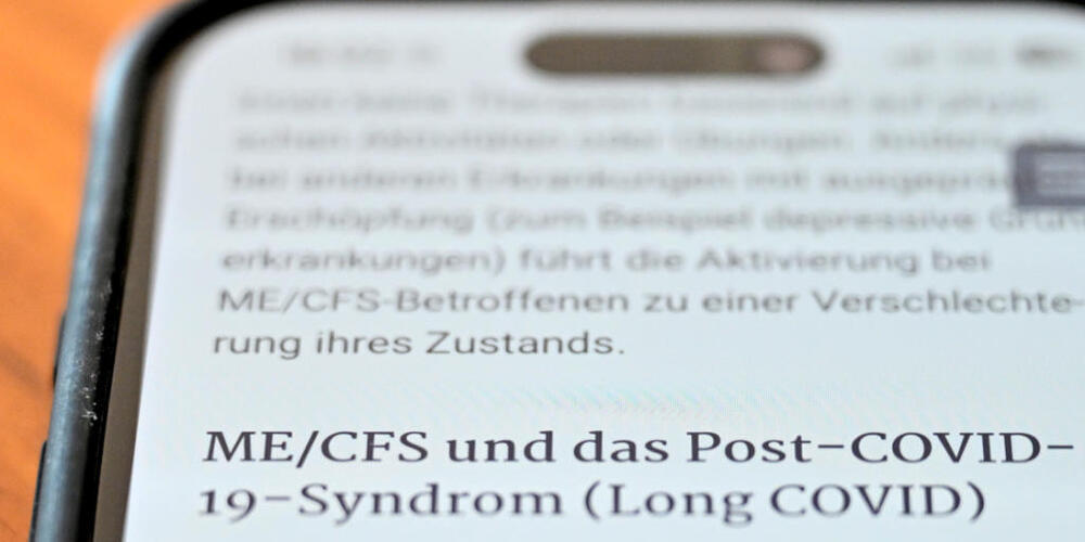 Im Kanton Zürich leben schätzungsweise zwischen 6000 und 7000 Menschen die an Long Covid oder ME/CFS erkrankt sind. (Symbolbild)