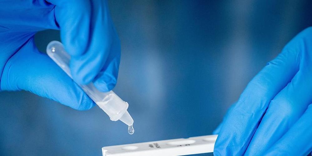 Die Lösung eines Abstrichs wird auf auf die Antigen Testkasette geträufelt.