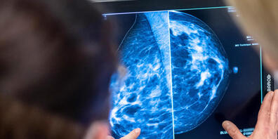 Der Schaffhauser Regierungsrat will so rasch wie möglich ein Brustkrebs-Früherkennungsprogramm einführen. (Symbolbild)