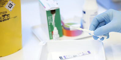 Die Stadt Zürich verstärkt den Kampf gegen Geschlechtskrankheiten. (Symbolbild)