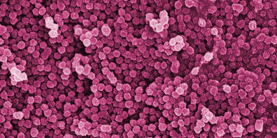 Nanopartikel in 150'000-facher Vergrösserung: Sie sind unsichtbar für das blosse Auge, in der Umwelt wohl aber weit verbreitet. Noch bestehen grosse Wissenslücken zu den winzigen Teilchen. (Pressebild)